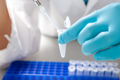 Know in brief about In Vitro Toxicity Testing