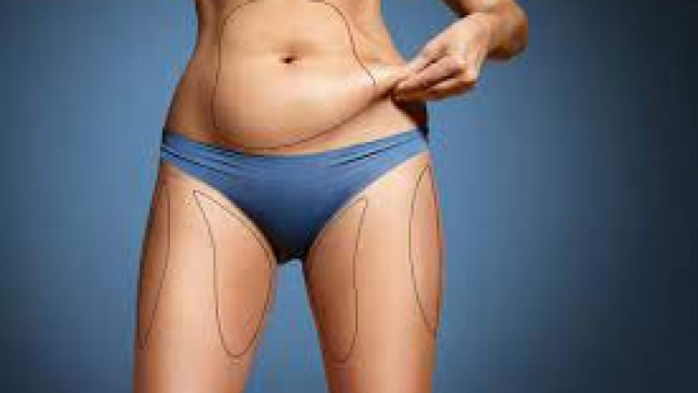 7 Benefits Of Body Contouring Without Surgery