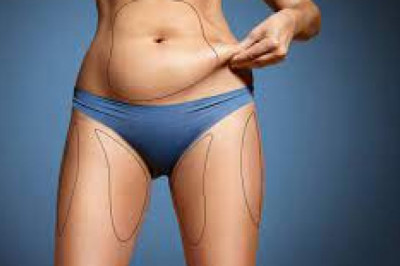 7 Benefits Of Body Contouring Without Surgery