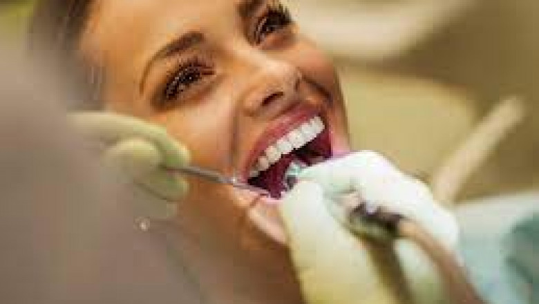 Why would I need my teeth whitened?