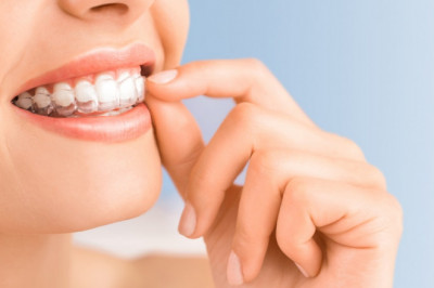 Everything You Need To Know About Invisalign – Tower House Dental Clinic