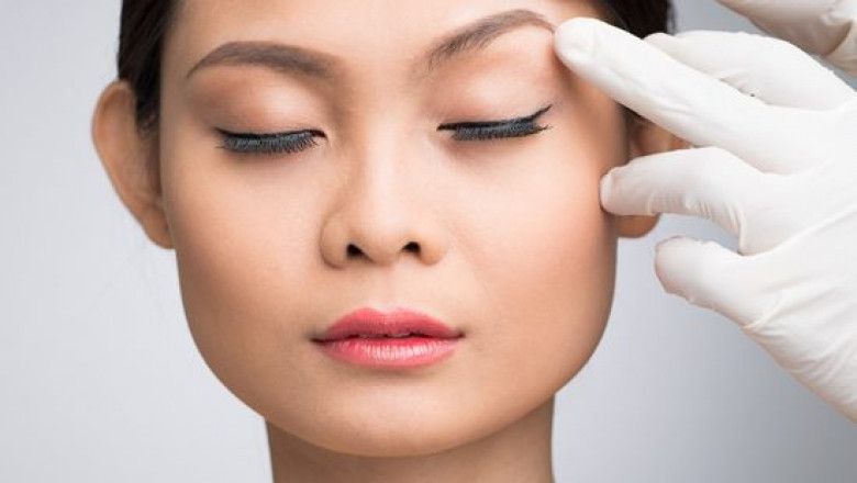 What is a Brow Lift?