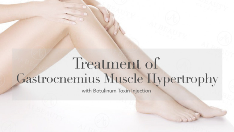 Calf Reduction Overview - Cost, Recovery, Before & After