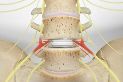A Quick Guide to Some Popular Spine and Brain Treatments in San Antonio, TX