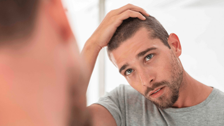 What is FUT hair transplant? Explain the procedure and benefits?