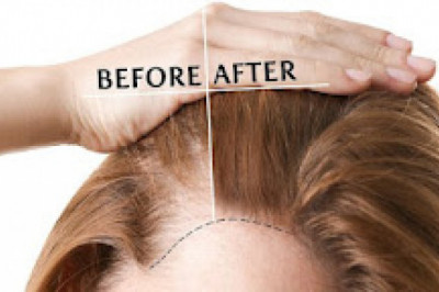 How Can Hair Loss be Treated, and What are Some Common Causes?