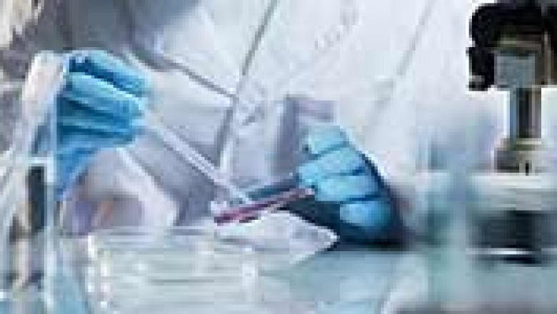 The Adoption of New Technologies In Cell Expansion Market