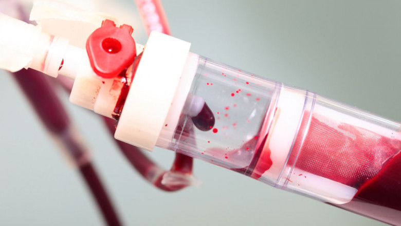 Blood-Based Biomarker for Alzheimer's disease