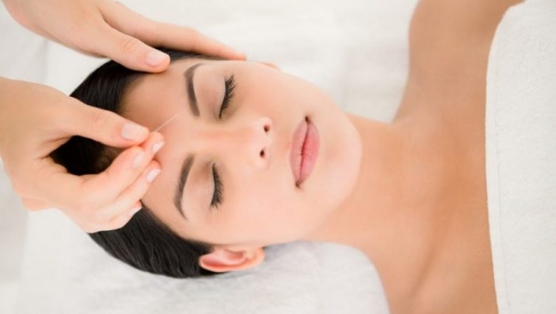 Cosmetic Acupuncture - Acupuncture on Facial Elasticity