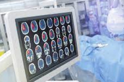 What Are The Most Common Neurosurgical Procedures?