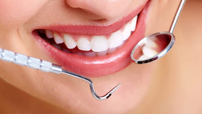 What Do You Know About Tooth Abscesses?