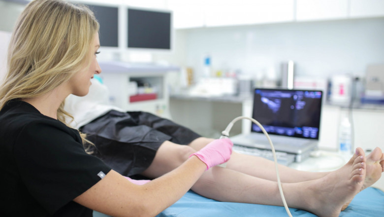 For How Long Do Varicose Veins Last?