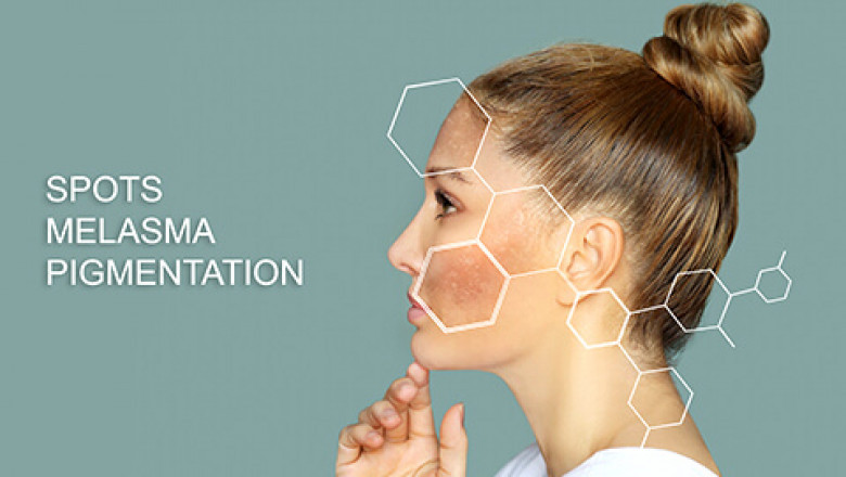 Popular Skin Treatments For Clearing Blemishes