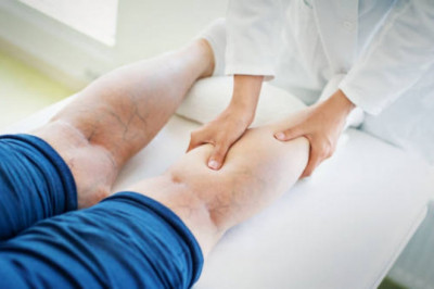The Global Varicose Vein Treatment Market will be Dominated by User Friendly Devices with a Greater Emphasis on Safety and Efficiency