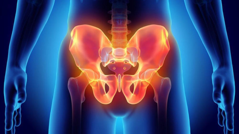 Chronic Pelvic Pain Treatment Market Size, Status, Growth | Industry Analysis Report 2022-2028