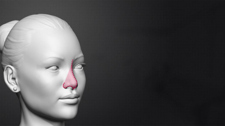 Rhinoplasty Cost in India