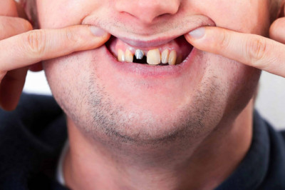 What to Expect During Regular Checkups?