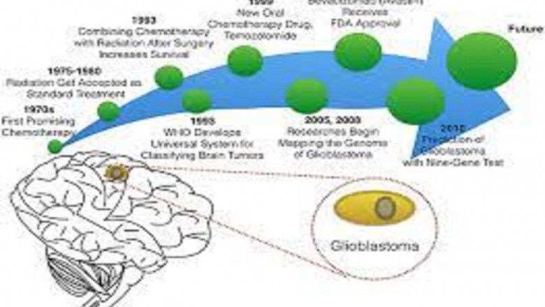 Global Glioblastoma Treatment Drugs Market Report, Latest Trends, Industry Opportunity & Forecast to 2028