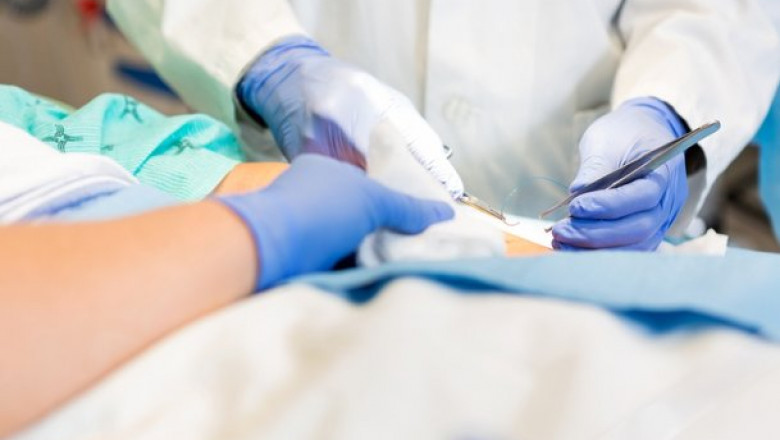 Post-Operative Surgical Wound Care - Essential Tips