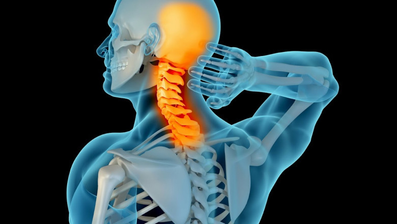 In addition to skin cancers, head and neck cancers can also be a form of lymphoma
