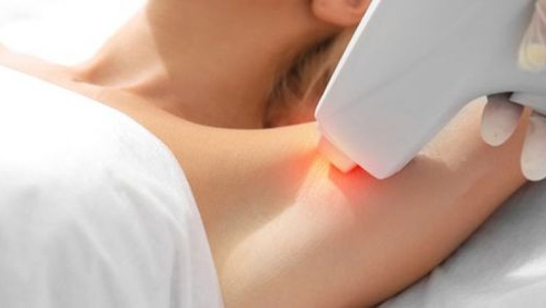 What hair removal equipment is used in beauty salons now?