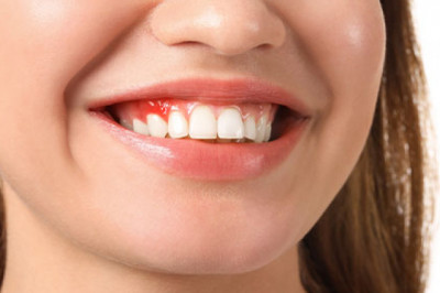 Why Should You Visit A Good Dentist At Regular Intervals?