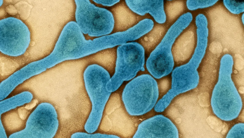 Marburg Virus Outbreak: Here is What You Need to Know