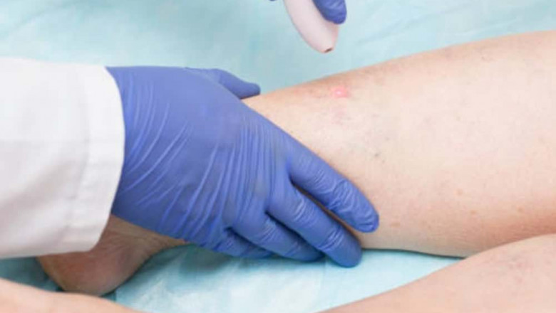 Who Are Vein Specialists?