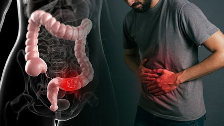 Top Herbal Medicine - Natural Constpation Medicine For Seena?