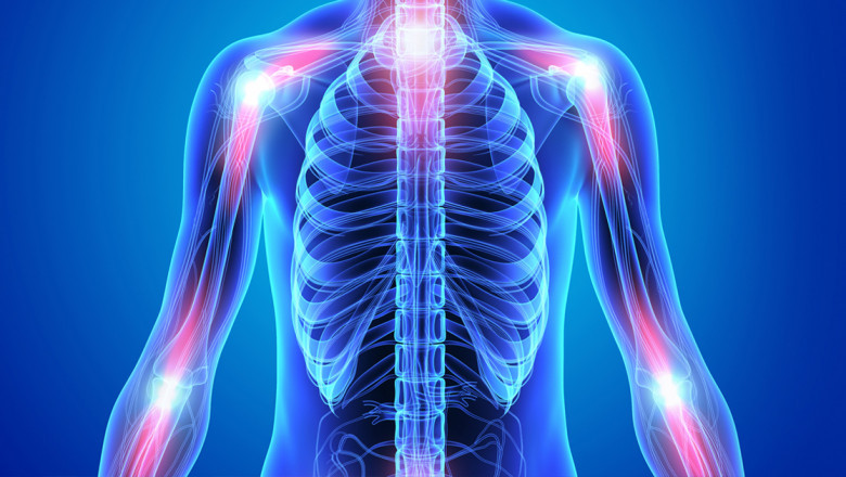 Top Herbal Medicine - Unani Medication Method For Inflammation Treatment ?