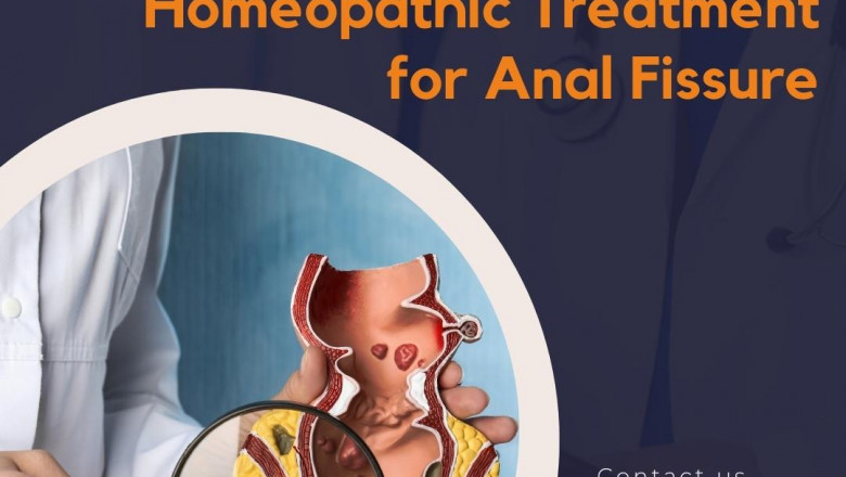Get Homeopathic Medicine for Fissure for better Results