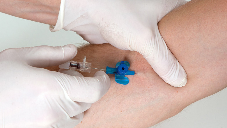 Global Intravenous Solutions Market: Trends, Share, Size, Growth, Opportunity and Forecast 2022-2030