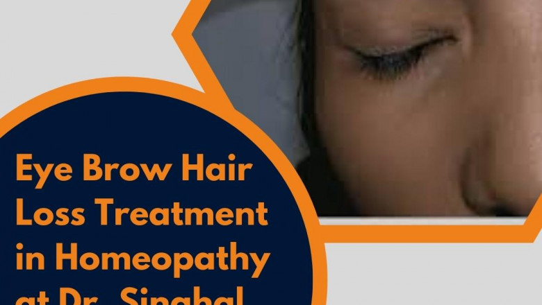 Homeopathic Medicine for Eye Brow Hair Loss Treatment