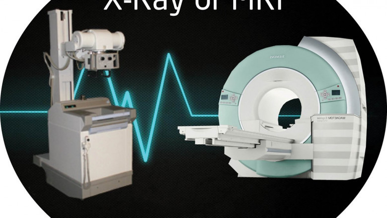 MRI or X-Ray?