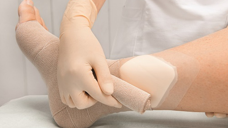 As an alternative treatment option for burn patients, wound care biologics are gaining popularity