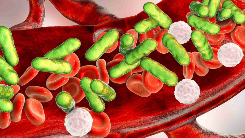Sepsis Diagnostic Overview
