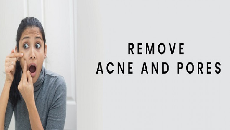 Acne Laser Treatment In Chennai