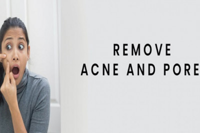 Acne Laser Treatment In Chennai