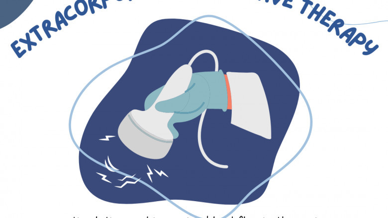 What is extracorporeal shockwave therapy for erectile dysfunction?