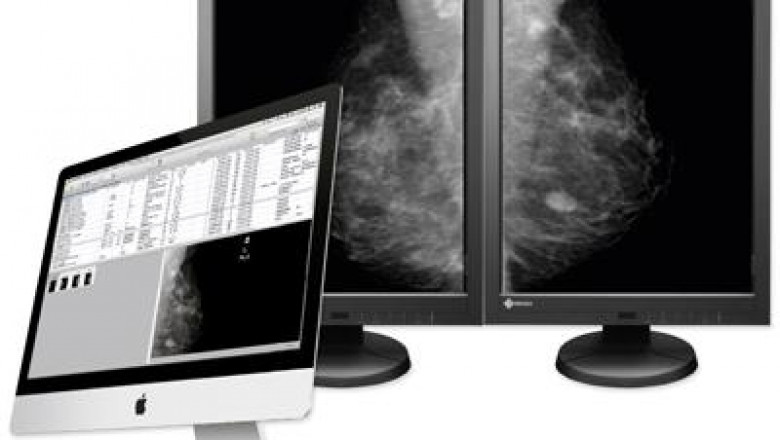 Computer Aided Detection Market Size, Share, Regional Overview and Global Forecast to 2028