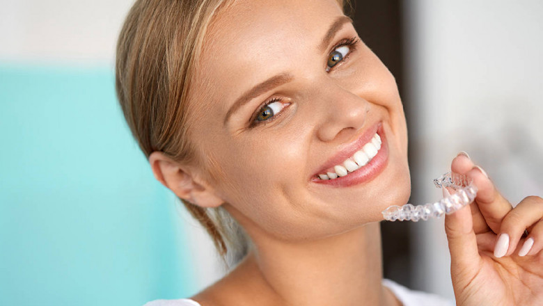 Invisible Orthodontic Aligners | SD Align
