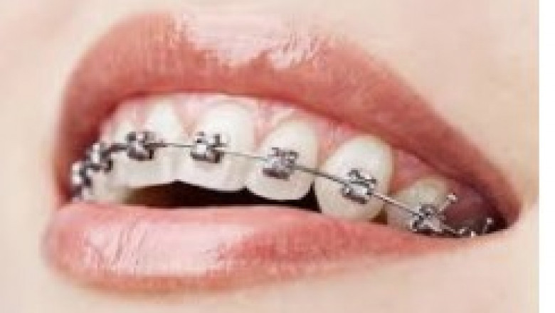 Cosmetic Dentist: Your Partner For That Perfect Smile