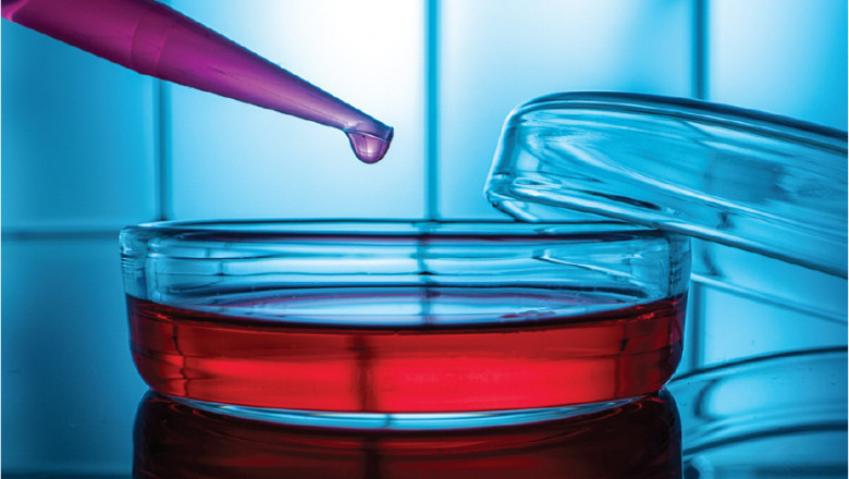 Fetal Bovine Serum Market to Expansion during 2022–2030