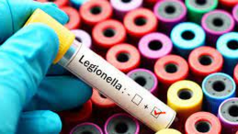 Legionella Testing Market 2022 | Industry Demand, Fastest Growth, Opportunities Analysis and Forecast To 2028