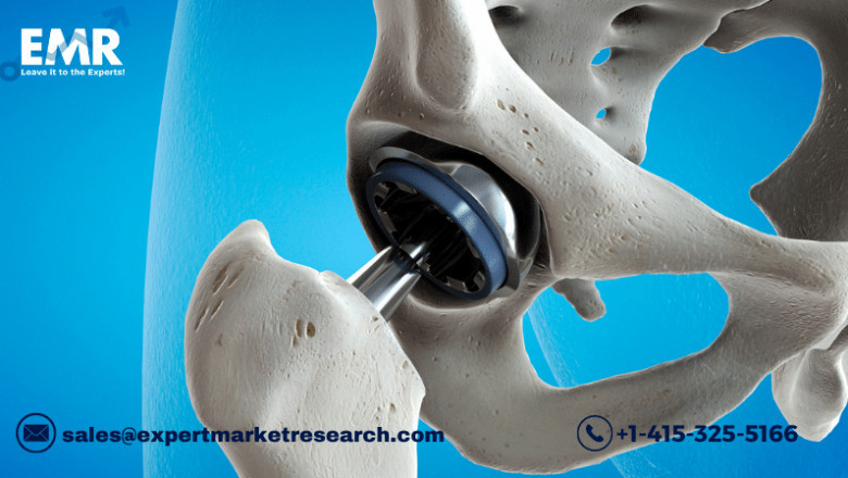 Global Orthopaedic Digit Implants Market To Be Driven By The Rising Prevalence Of Orthopaedic Diseases In The Forecast Period Of 2021-2026