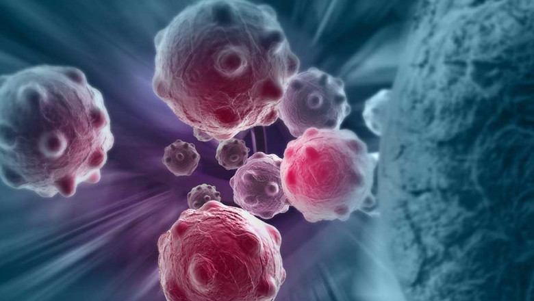 In this report, we provide an analysis of the Immuno-Oncology Market: Trends, Size, Share, Growth, Opportunities, and Forecast 2020-2027.