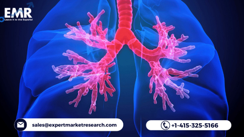 Global Lung Stent Market To Be Driven By The Increasing Prevalence Of Lung Cancer In The Forecast Period Of 2021-2026
