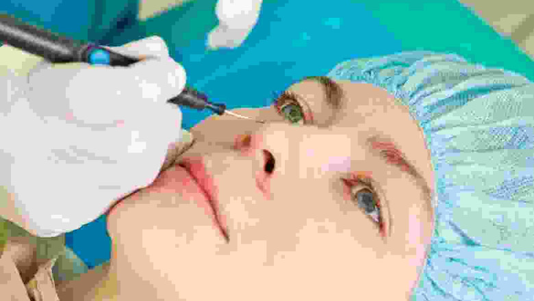 Ladies of Fashion Taking Interest in Hair Fall Treatment