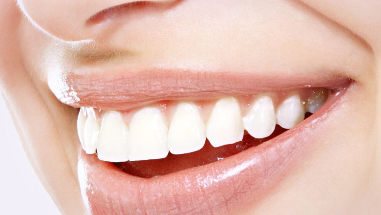 Which Is Better, Invisalign Or Braces?