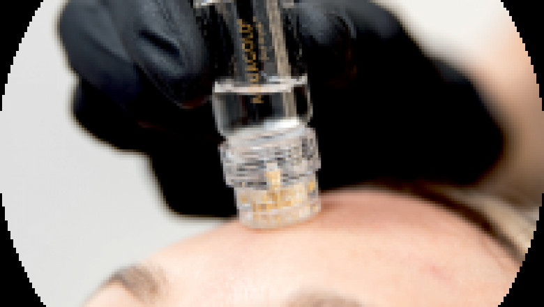 Microgold Infusion Facial Treatment | Medical Facial | Musk Clinic